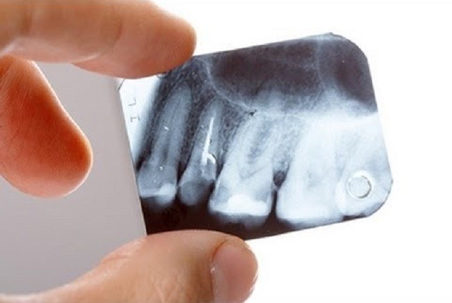 The stem cell tooth